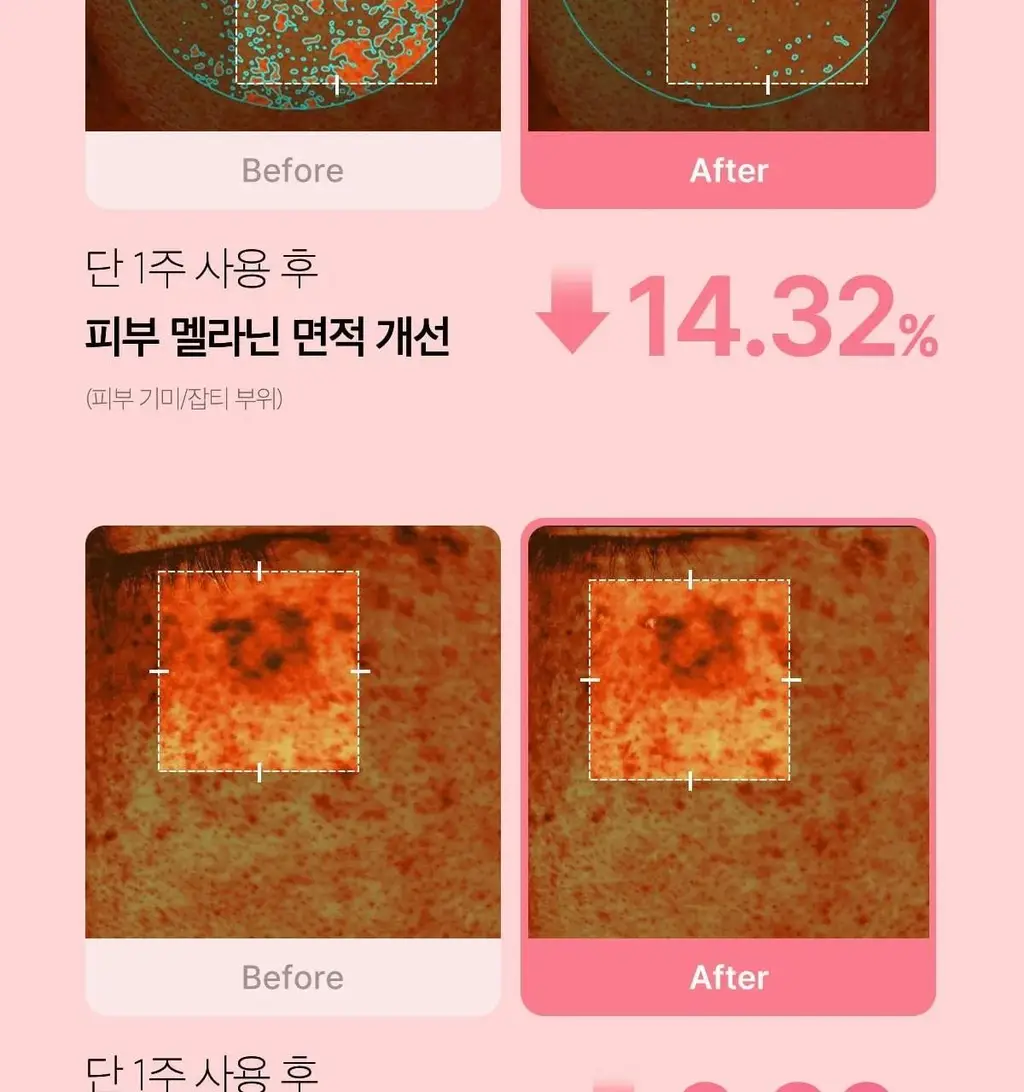 [쿨링광채]메디큐브 PDRN 핑크 콜라겐 토닝 겔 토너패드 70매 기획(본품70매+겔패드10매) 상세페이지 35